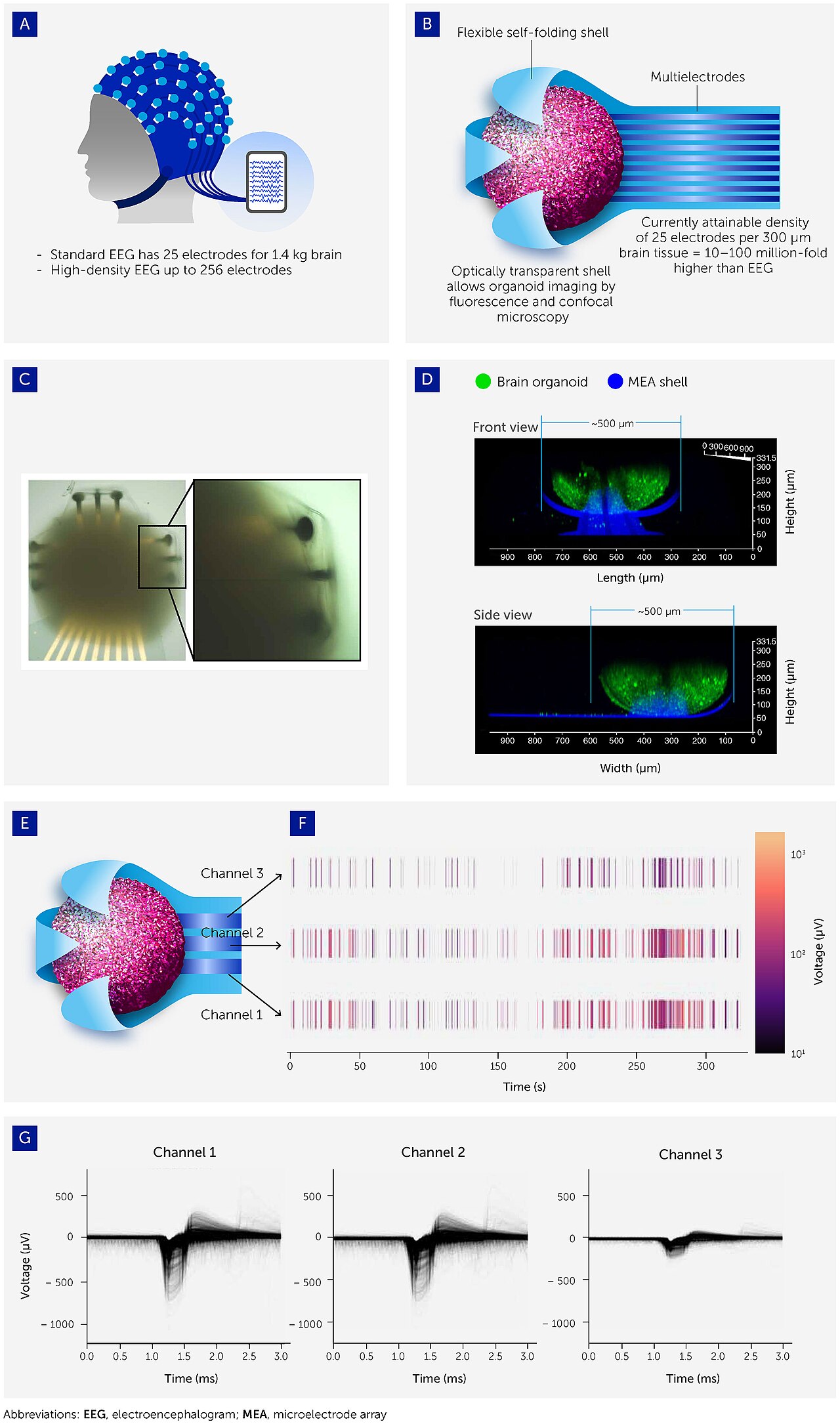 brain computer interface electrode array