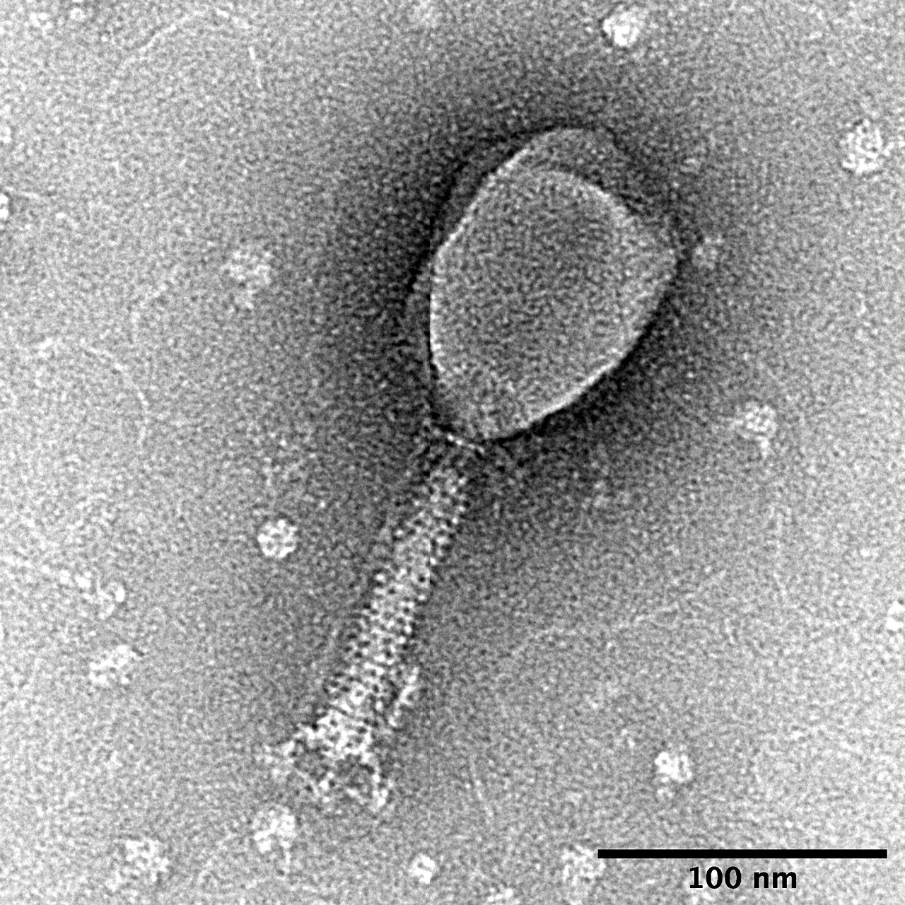 bacteriophage electron micrograph